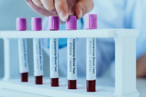Convenience at Your Fingertips: Ordering Your Blood Tests Online Convenience at Your Fingertips: Ordering Your Blood Tests Online